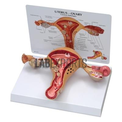 Human Natural Uterus