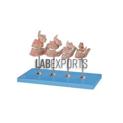Human Teeth Model, Dentition Development on Stand
