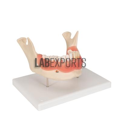 Human Teeth Model, Lower Jaw, on Stand