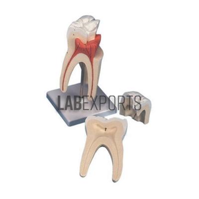 Human Teeth Model, Triple Root Molar