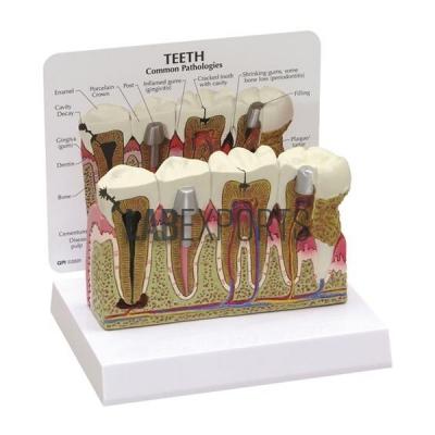Teeth Model With Description Plate