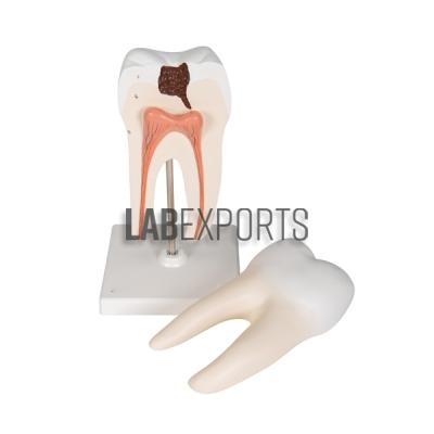 Human Teeth Lower Molar With Root Anatomy Model
