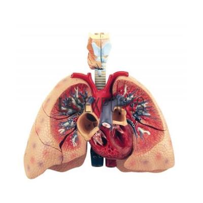 Human Lungs with Heart and Larynx