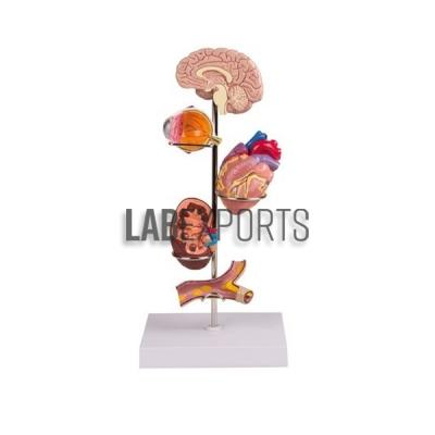 Human Hypertension Model, 6 Parts