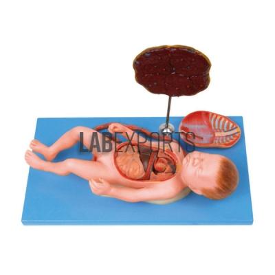 Fetus with Viscera and Placenta