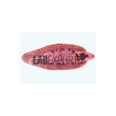 Fasciola (Liver Fluke)