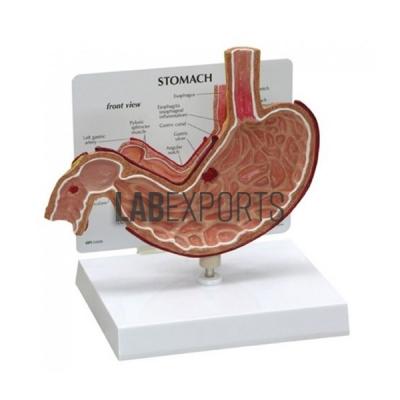 Human Stomach
